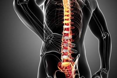 Musculoskeletal Pain