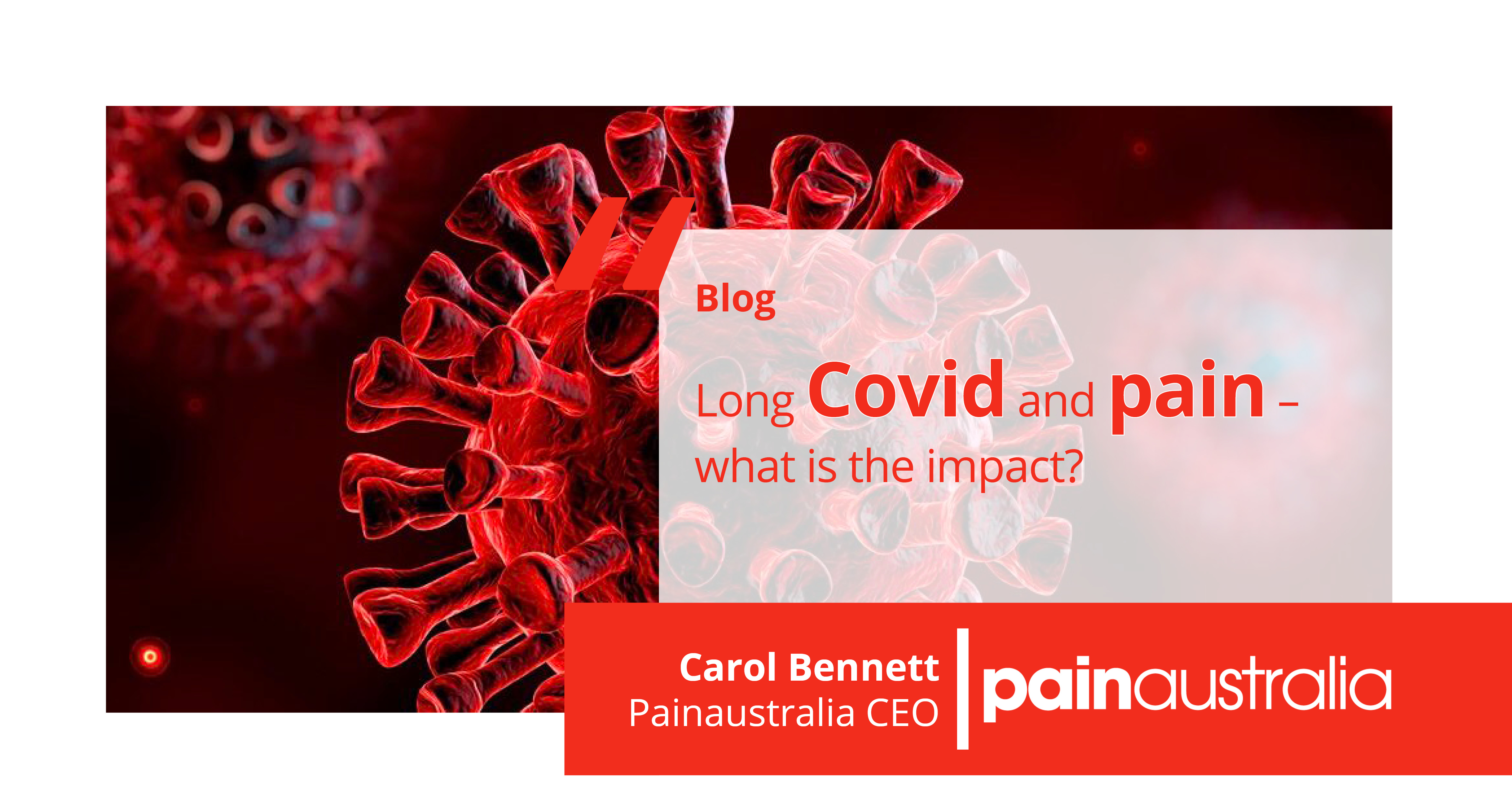 Long Covid and pain what is the impact?